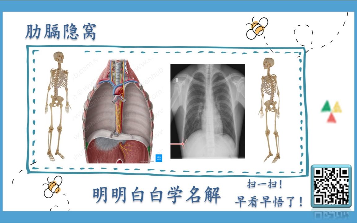 明明白白学名解—肋膈隐窝(局部解剖学)哔哩哔哩bilibili