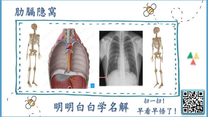 肋膈隐窝图片图片