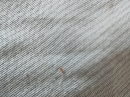 这小红蚂蚁咬人贼疼,被咬后也有一阵阵的刺痛,谁知道这是什么品种