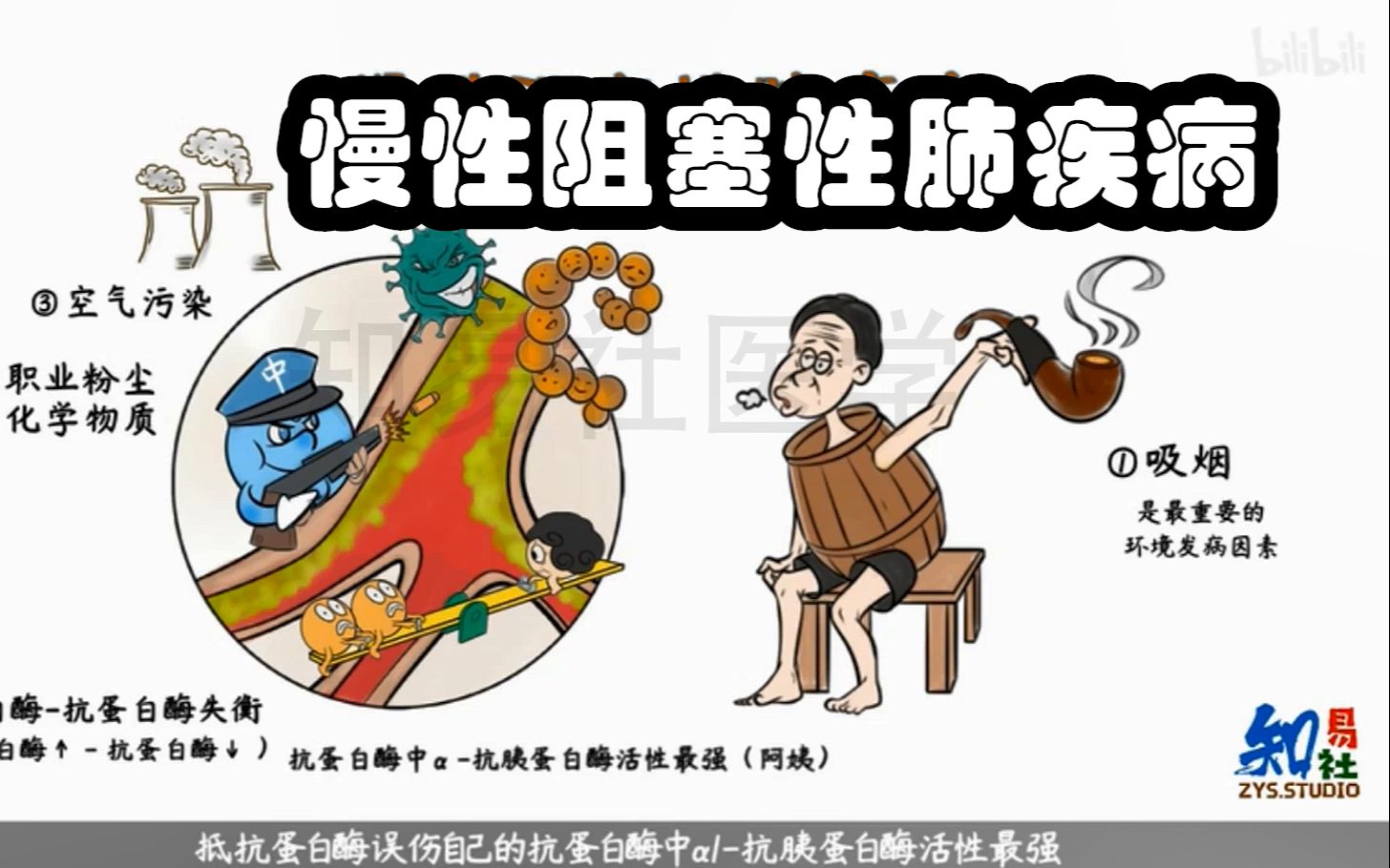 医学带背 3分钟记住 慢性阻塞性肺疾病copd的病因和发病机制