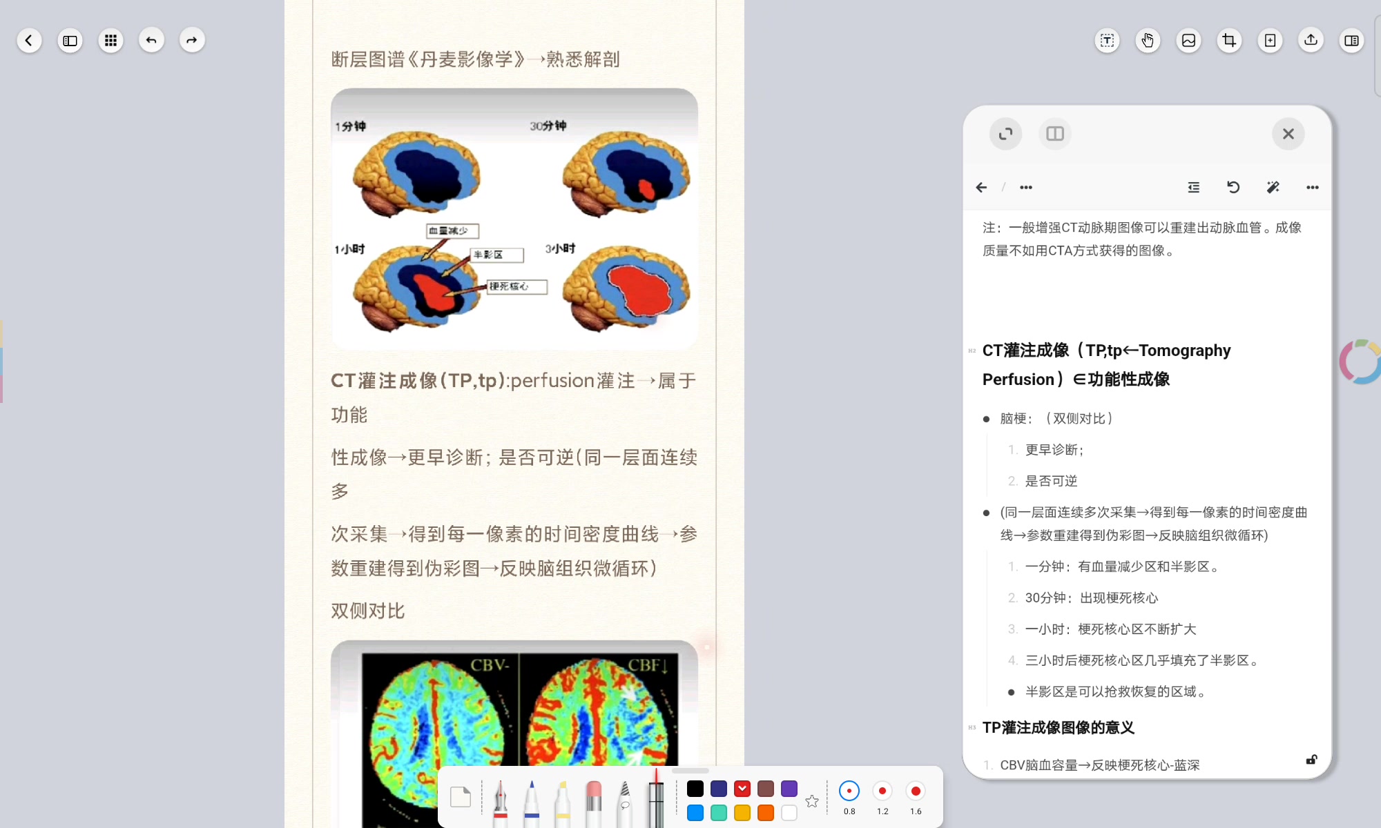 影像读片复盘 头颈部 脑血管性疾病缺血性脑卒中(脑梗)2ct灌注成像TP&磁共振灌注成像PWI哔哩哔哩bilibili