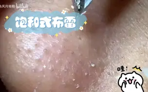 Descargar video: 饱和式布雷