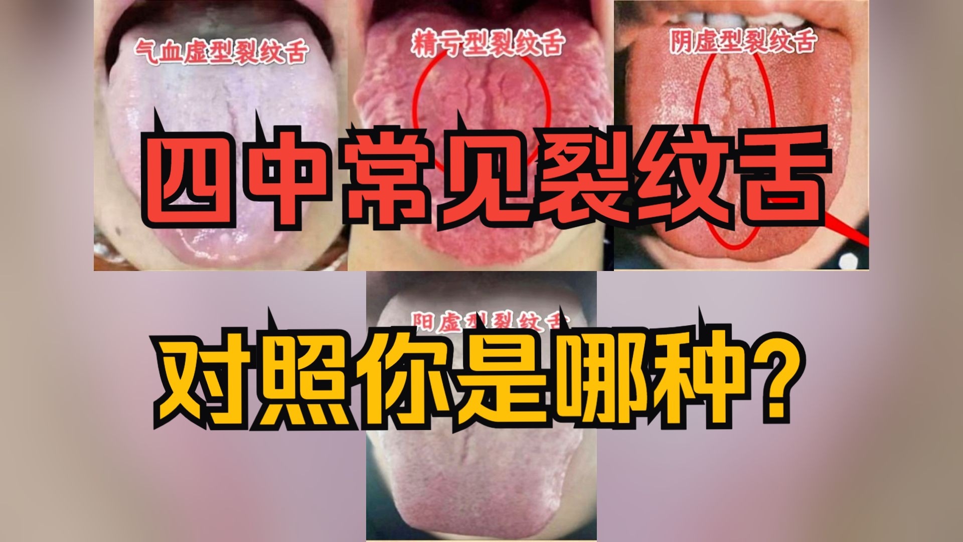 舌头裂纹越长,人的寿命越短!4种常见舌裂舌,一个视频讲清楚!