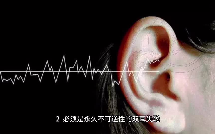 活动作品双耳失聪什么程度才能获得理赔