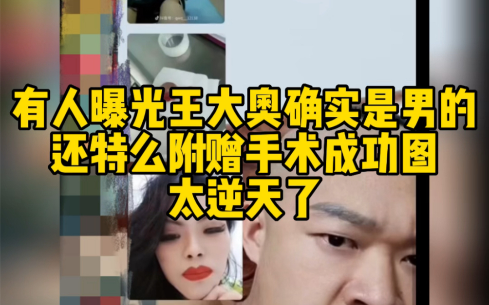有人曝光王大奥确实是男的还特么附赠手术成功图太逆天了
