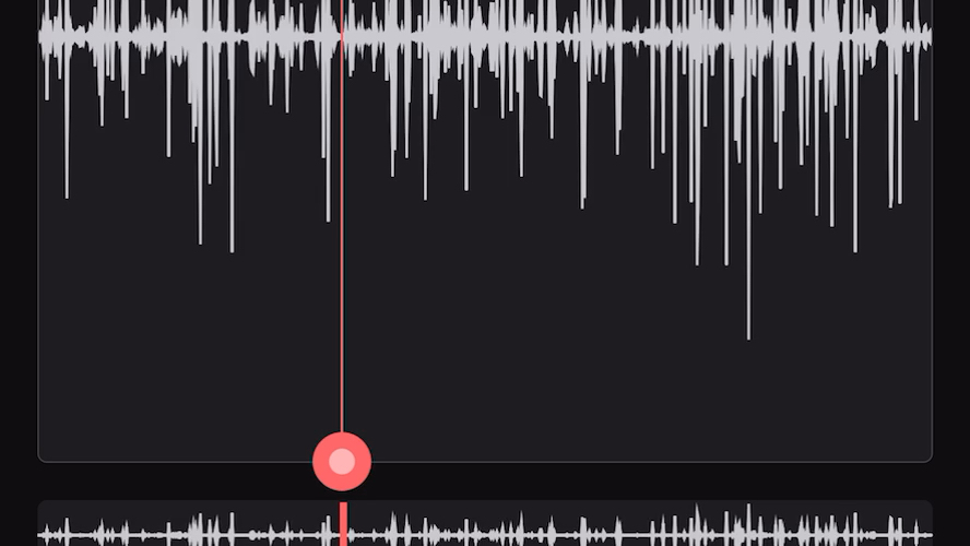 20191211肠鸣音左下腹部流水音(气过水声)肚子里的水流声哔哩哔哩bilibili