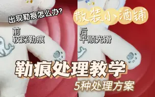 Download Video: 【棉花娃娃勒痕处理】超级干货，5种方法教会你正确处理勒痕