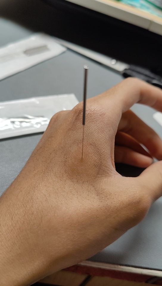 练习扎合谷,难得好似扎到神经了捻蹭了下晃的厉害