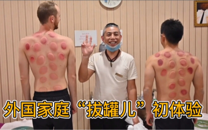 American family and friends experienced "Chinese massage" and "cupping" for the first time, and my father became even more obsessed with Chinese culture!