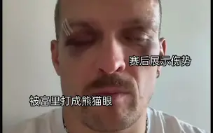 Скачать видео: 乌西克赛后展示伤情:被富里打成熊猫眼了，自乌西克比赛以来第一次收到这么明显的伤势