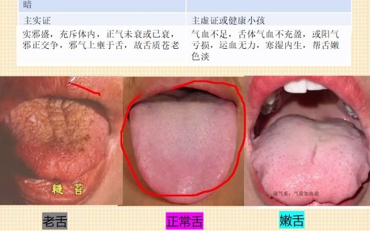 老舌和嫩舌有啥区别图片