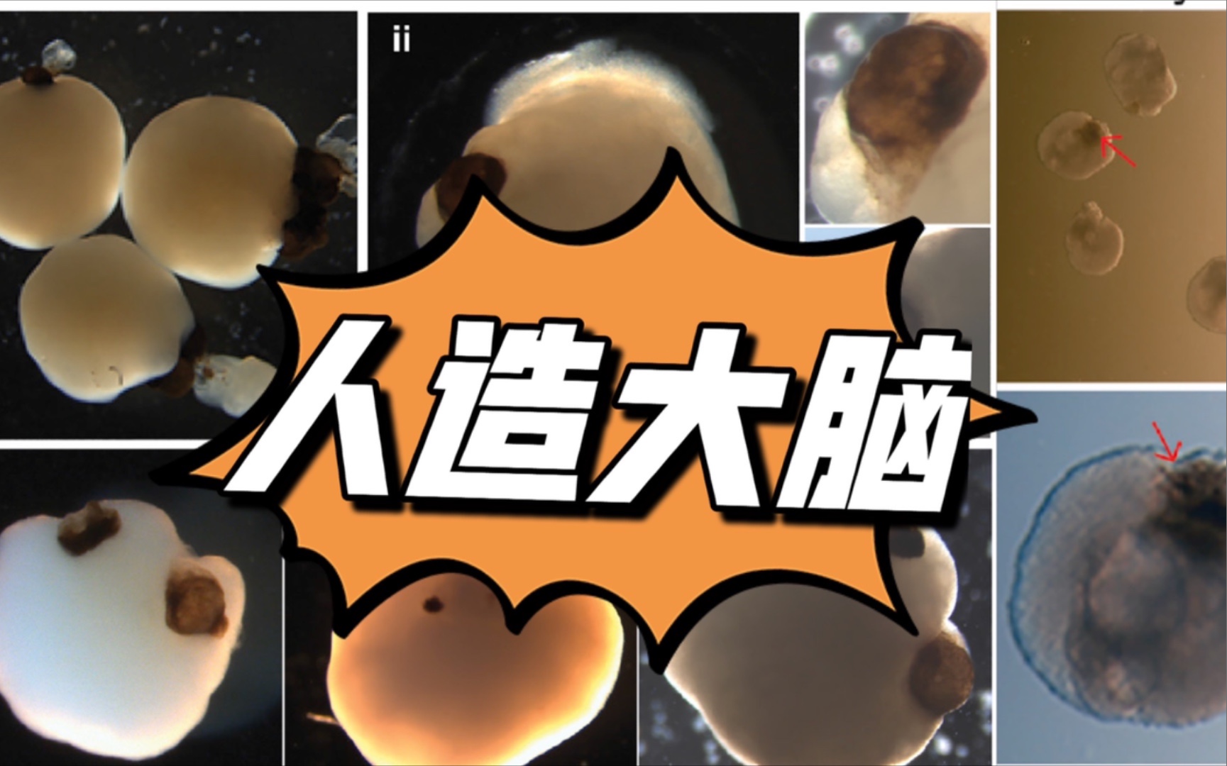 有趣论文摘要 | 人造大脑长出眼睛 类脑器官 人类诱导性多功能干细胞