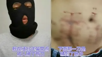 Download Video: 可怕！男子讲述被骗去缅北诈骗：逃跑被捅2刀，还要付空气磨损费