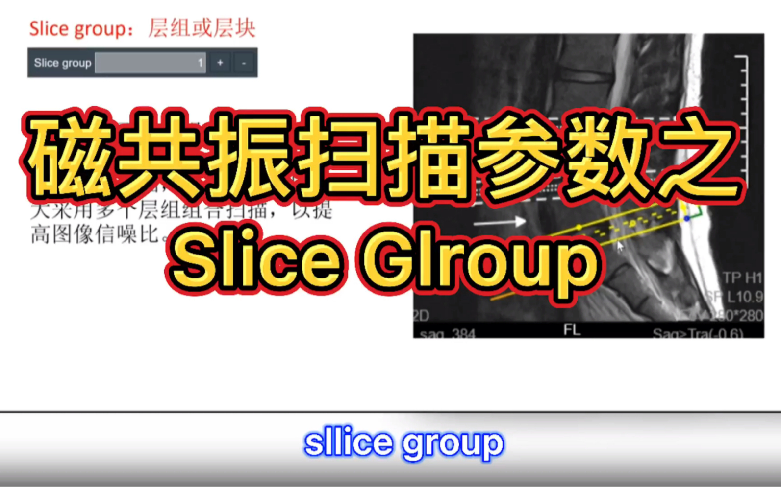 「磁共振序列解说」西门子参数卡解说之层组Sllce Group哔哩哔哩bilibili