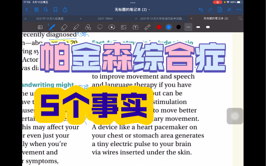 [图]202期 英语报刊精读 美国读者文摘Reader Digest 关于帕金森综合症的五个事实 科普类文章