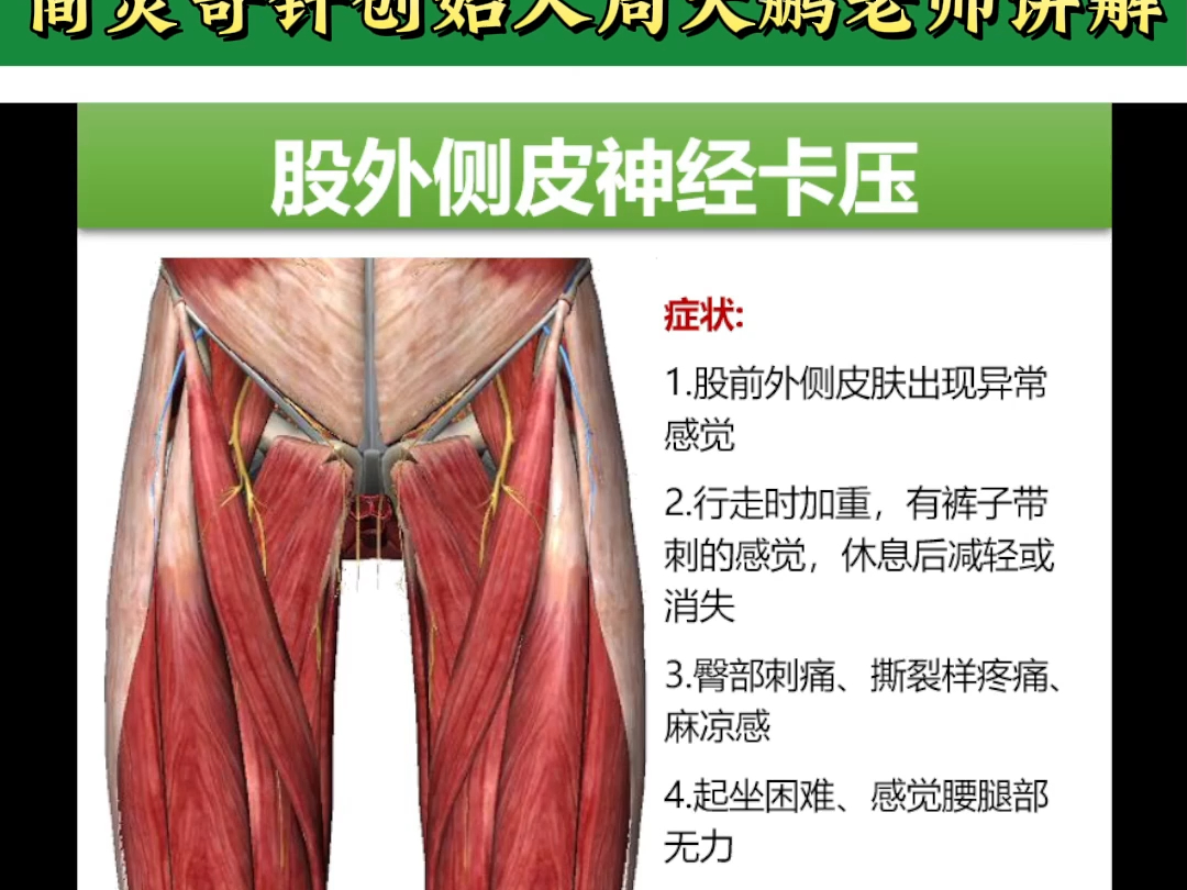 股外侧皮神经卡——4个方面全方位讲解——天下明医平台简灵奇针