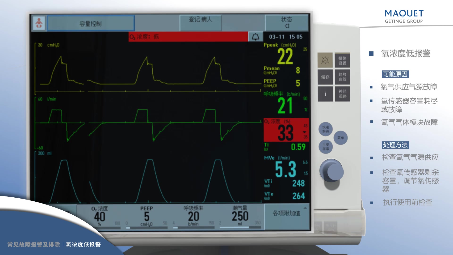 呼吸机迈柯唯Maquet Servos/Servoi操作指南哔哩哔哩bilibili