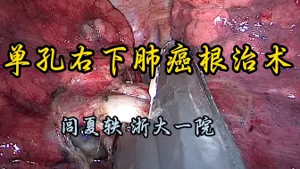 单孔胸腔镜右肺下叶癌根治术 详细解说版 闾夏轶教授供稿 1.5倍速未剪辑