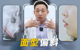 Descargar video: 正颌手术也不是万能的，轻度骨性偏斜还有哪些应对之策？