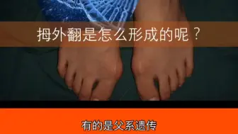 拇外翻是如何形成的？