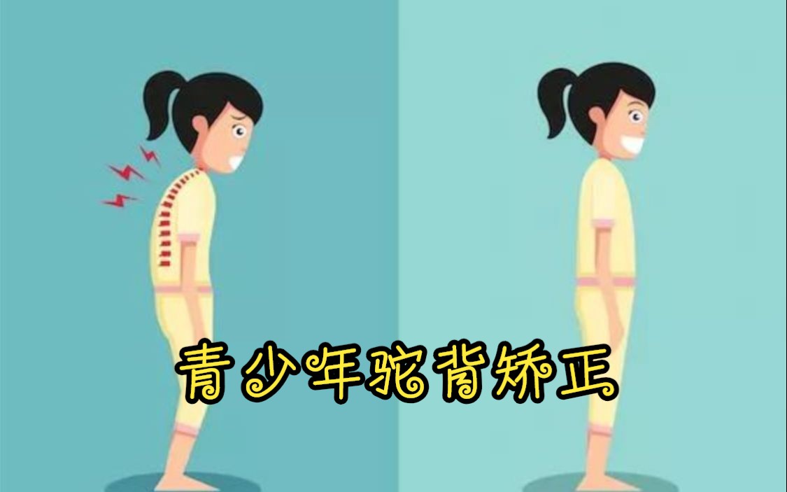 青少年驼背矫正