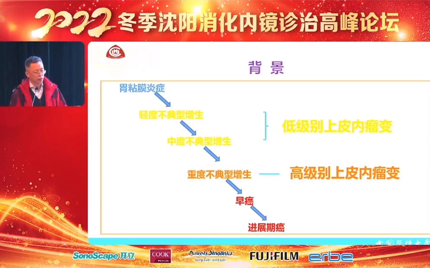 专家讲座:胃粘膜低级别上皮内瘤变内镜下射频消融治疗哔哩哔哩bilibili