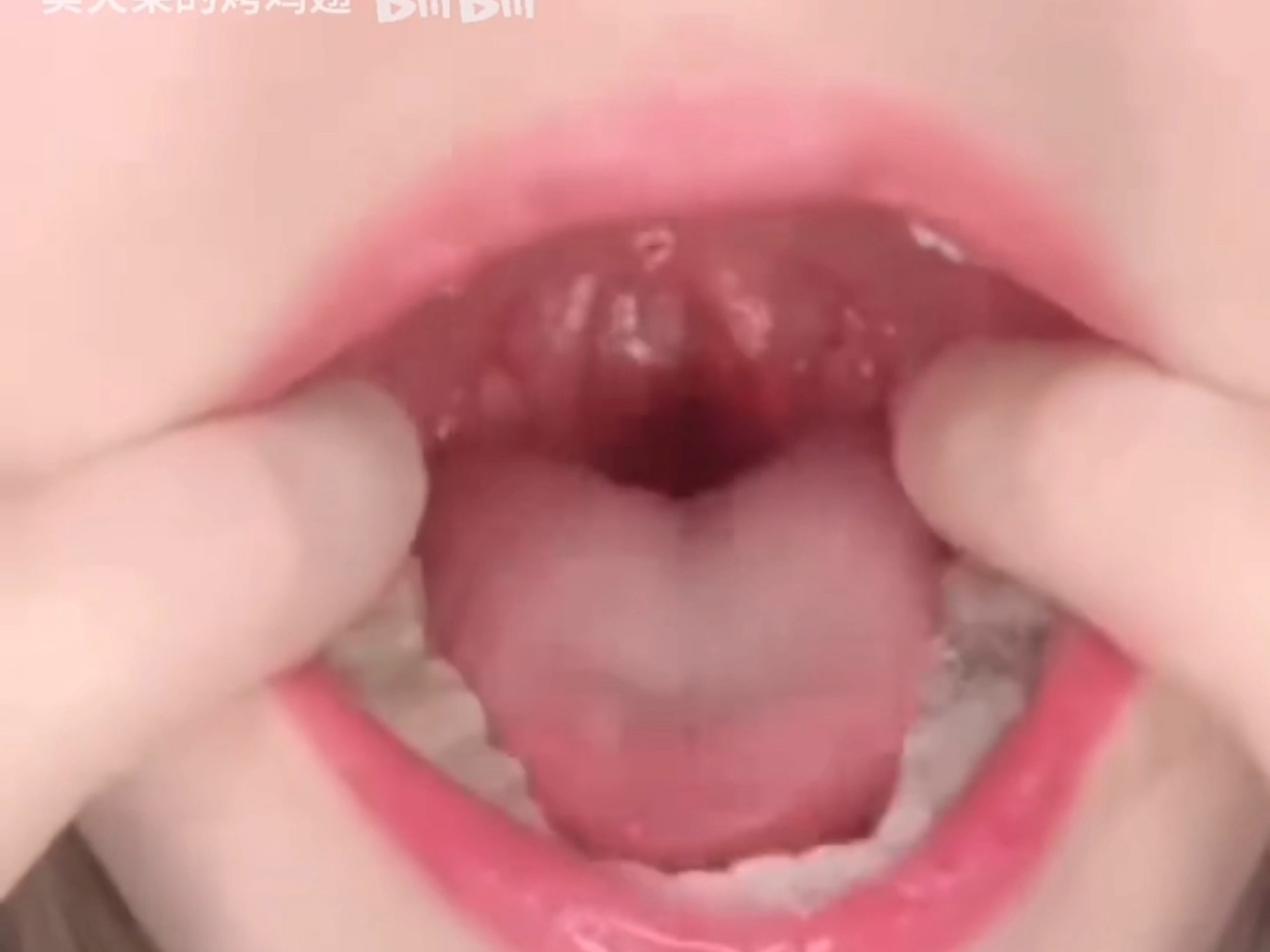 关注口腔健康，如有不适，请往线下就医