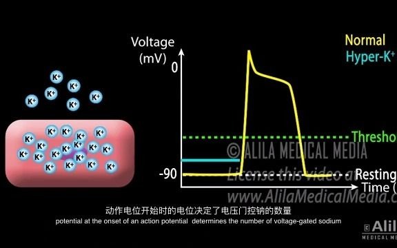 [图]【中英字幕】高血钾/低血钾 原因、症状、对心脏的影响、病理生理动画