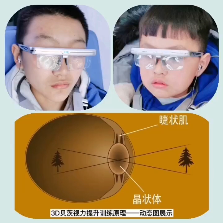 ...司通过智能动态变焦、声波疗愈科学的训练眼球增强眼部的调节功能,针对近视,老花,低度散光等屈光不正现象,通过训练提升裸眼视力哔哩哔哩bilibili