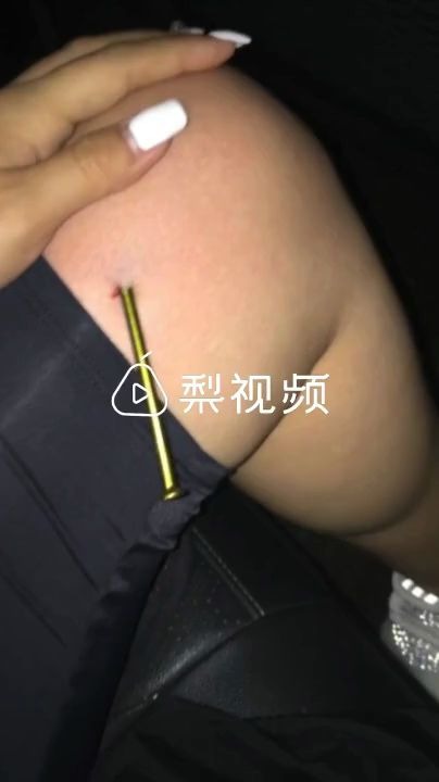 [图]隔屏看着疼！男子玩网红砸钉子游戏，钉子弹出扎旁边女子大腿