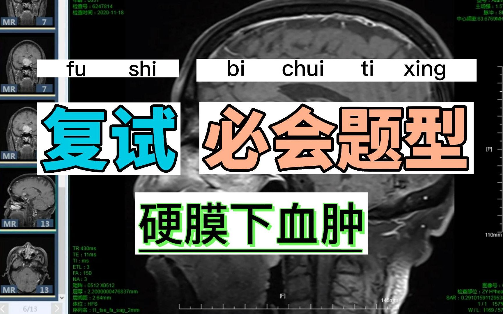 【中枢神经】颅脑外伤硬膜下血肿今年就上岸吧哔哩哔哩bilibili