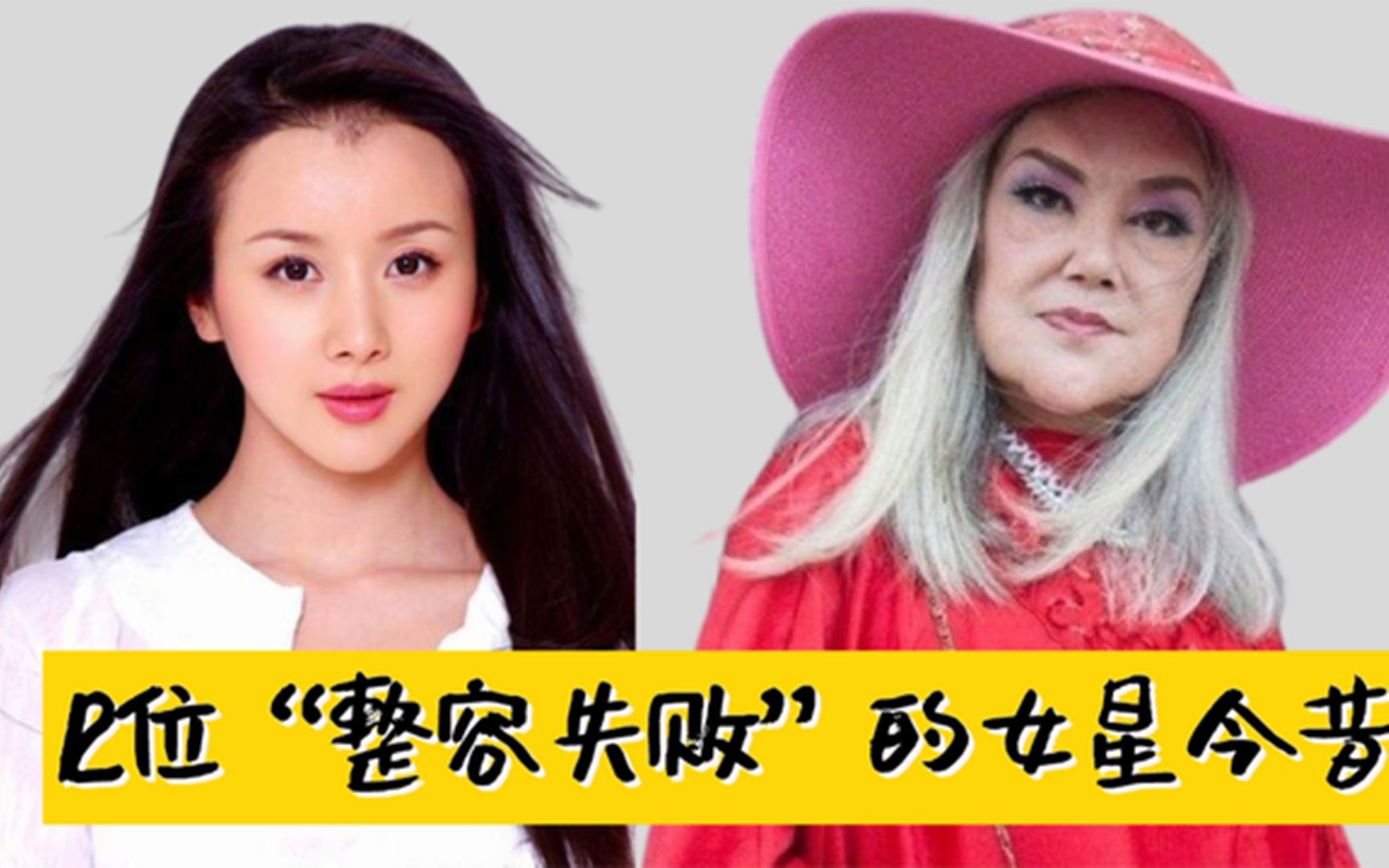 "整容失败"的女星,王祖贤塌陷式衰老,张檬放入硅胶迎颜值巅峰