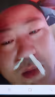 又一名重度空鼻病友，隔着屏幕都能感觉到他的绝望，痛苦，希望能撑下去吧。
