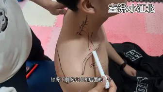 Télécharger la video: 小圆肌 导致肩疼的肌肉