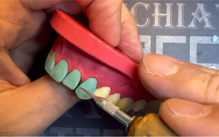 前牙蜡型全形态制作by merkuri lab#蜡型#牙匠之家