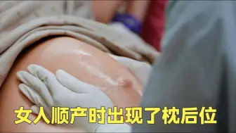 Télécharger la video: 女人生产时出现了枕后位，助产士徒手将胎位调转了过来