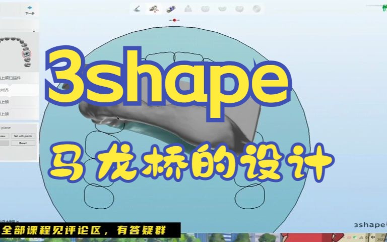 3shape马龙桥的设计哔哩哔哩bilibili