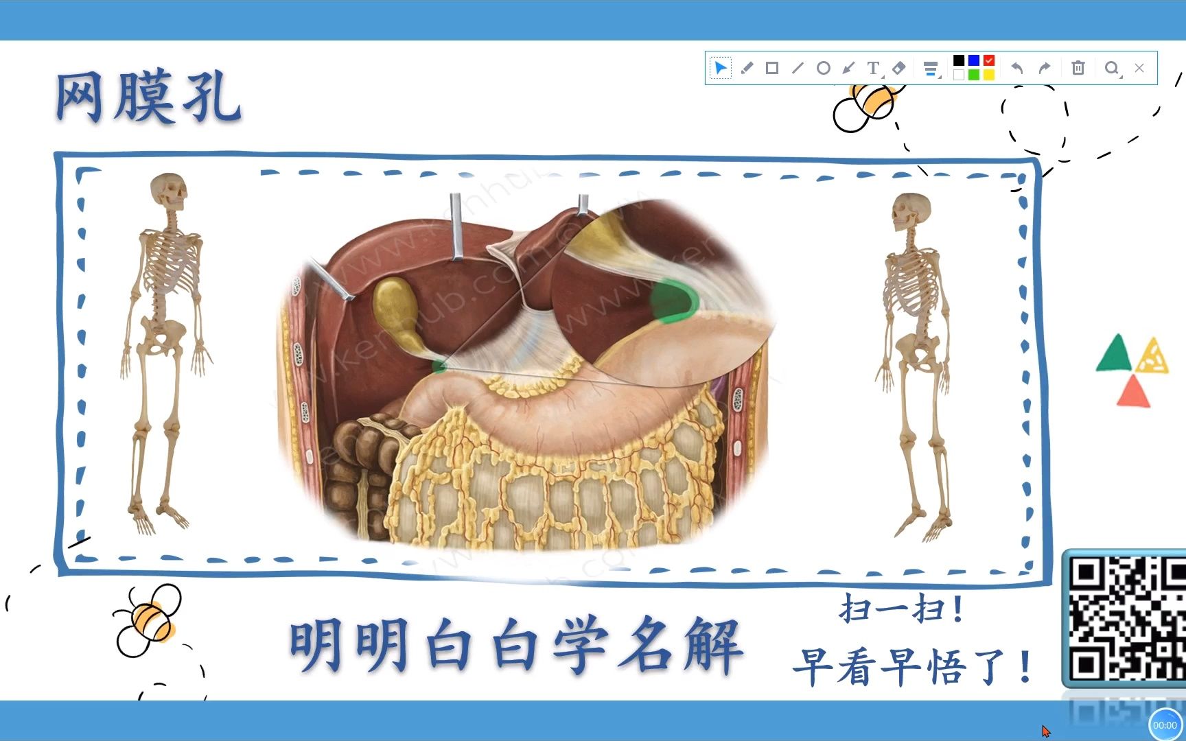 明明白白学名解—网膜孔(局部解剖学)哔哩哔哩bilibili