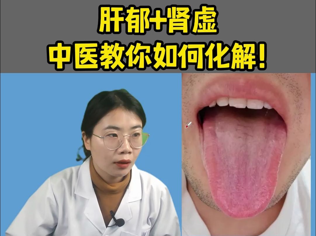 [图]潘大夫舌诊：肝郁+肾虚，中医教你如何化解！