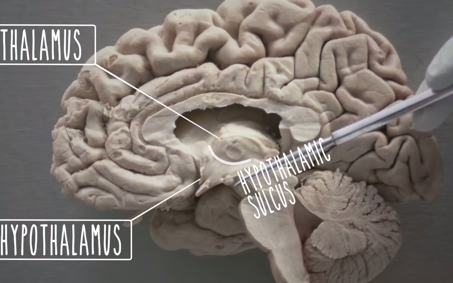 [图]下丘脑和边缘系统的解剖 Hypothalamus and Limbic System - UBC Neuroanatomy - Season 1 - Ep 4