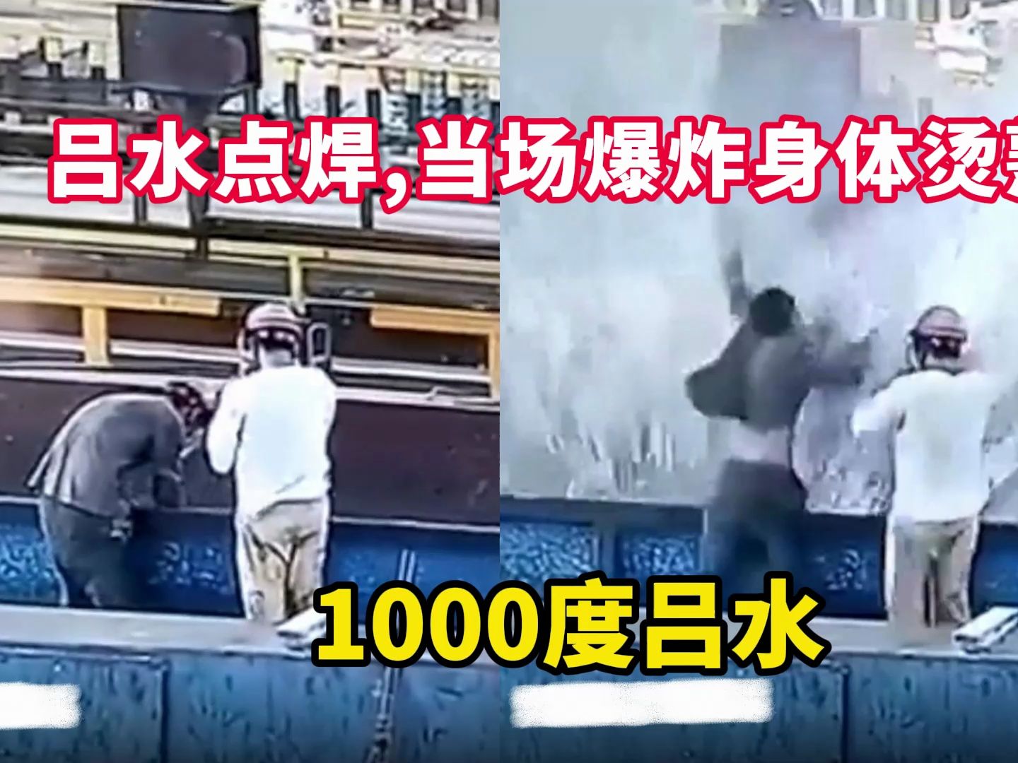 1000度吕液爆炸,全炸身体脸上当场熟了,太可怕了哔哩哔哩bilibili