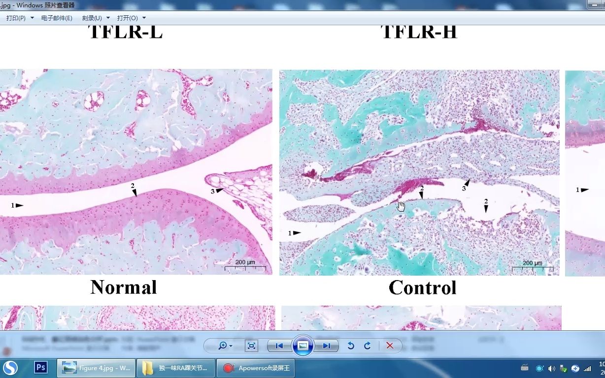 类风湿关节炎——胶原诱导性关节炎大鼠模型:踝关节HE和番红固绿染色哔哩哔哩bilibili