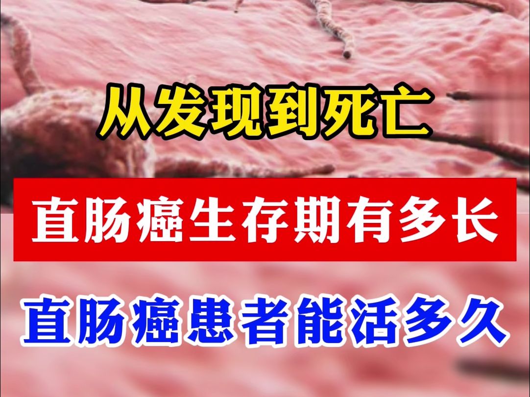 从发现到死亡,直肠癌的生存期有多长?直肠癌患者能活多久?哔哩哔哩bilibili