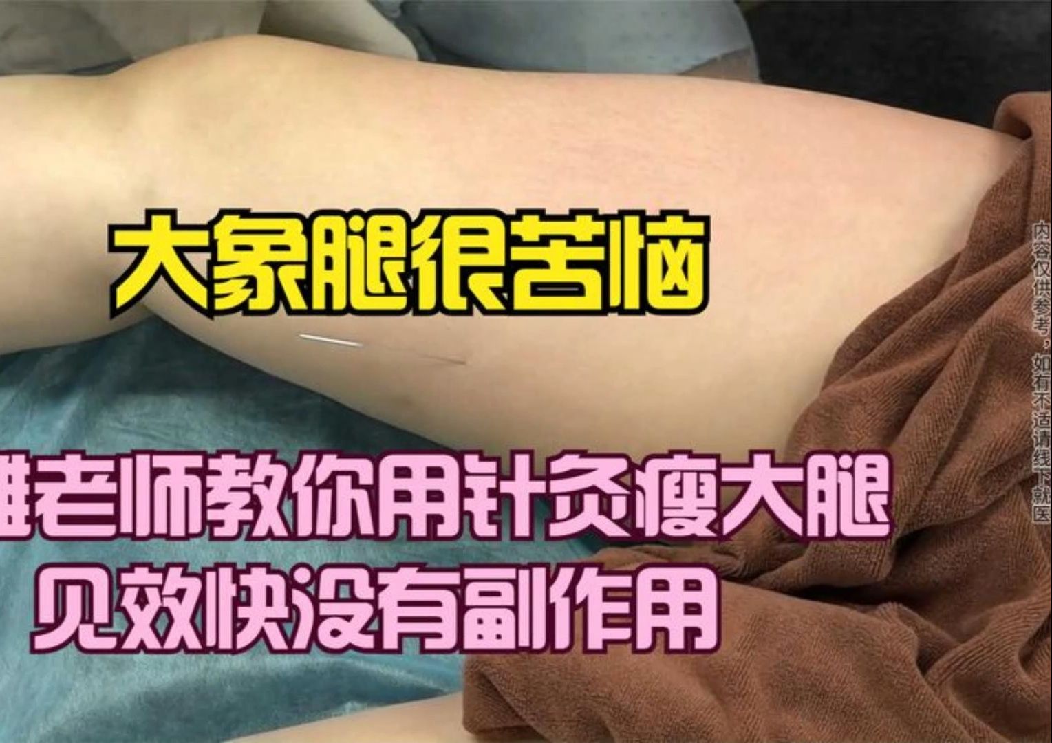 女人针灸大腿内侧图片