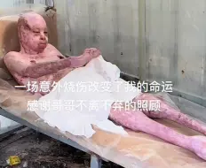 下载视频: 一场意外改变了我的命运，感谢哥哥不离不弃的照顾