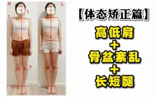 Video herunterladen: 体态矫正篇 | 高低肩+骨盆紊乱+长短腿