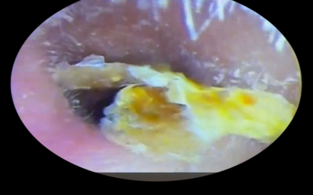 这个视频给你答案!给你解压,放松解压