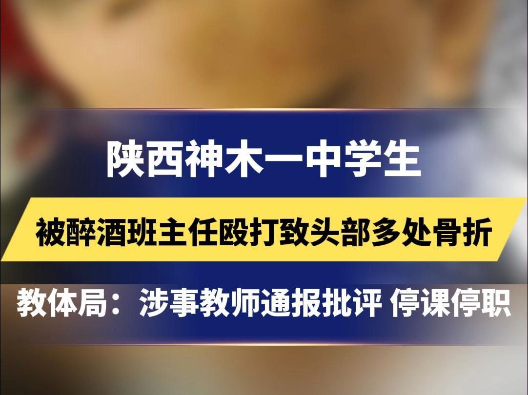 陕西神木一中学生,被醉酒班主任殴打致头部致多处骨,教体局:涉事教师通报批评 停课停职#陕西哔哩哔哩bilibili