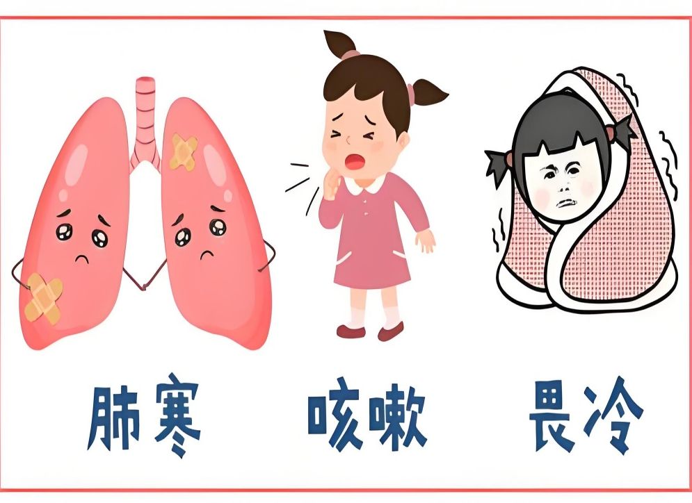 第129节:风寒袭肺证 — 鼻塞声重,喷嚏咳嗽,流清涕哔哩哔哩bilibili