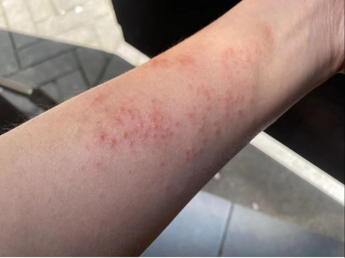 超容易复制的湿气除根技巧!简单4步在家完成,看完你会感谢我